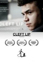  Заячья губа 