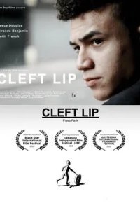  Заячья губа 