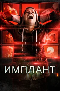  Имплант  1 сезон