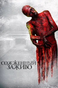  Сожженный заживо  1 сезон